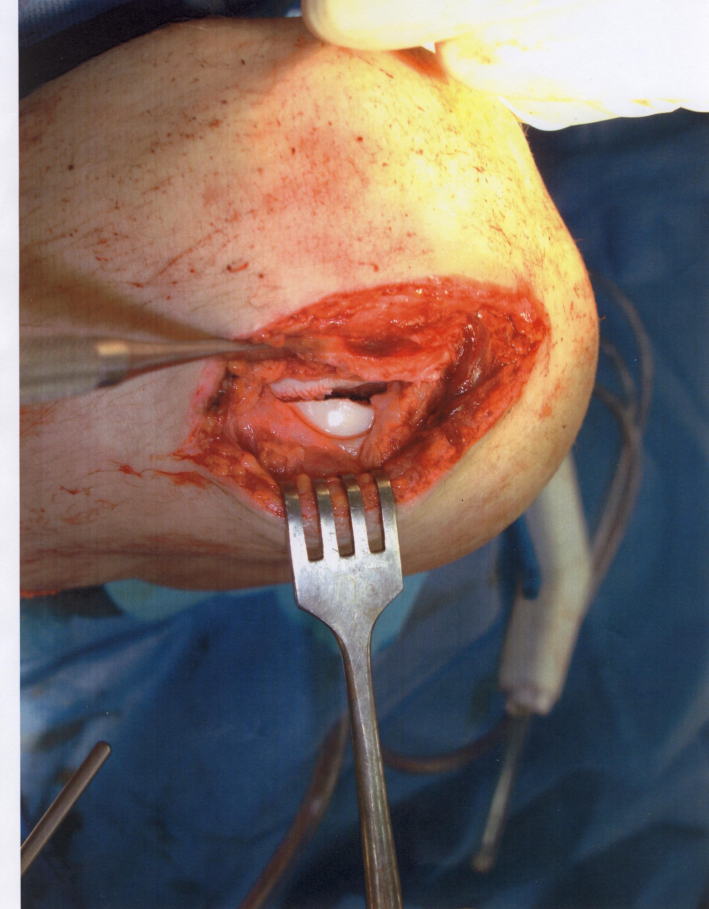 Alex's_knee_1.jpg
