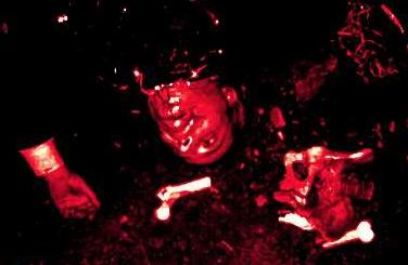 Bloody_Bits.jpg